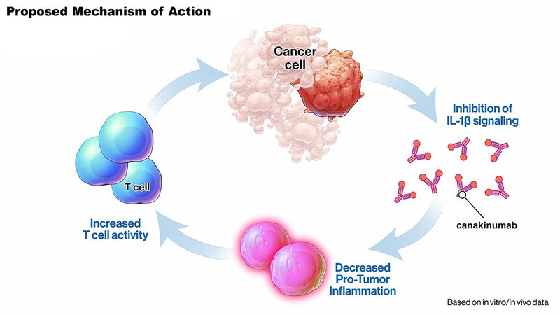  IL-1β抑制剂临床失利：非小细胞肺癌治疗路径的复杂性解析 新闻
